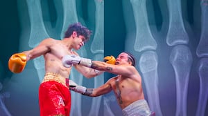 Mario Bautista sufre fractura tras nocaut en Supernova