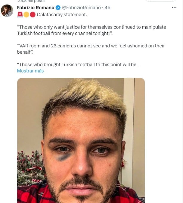 Mauro Icardi.