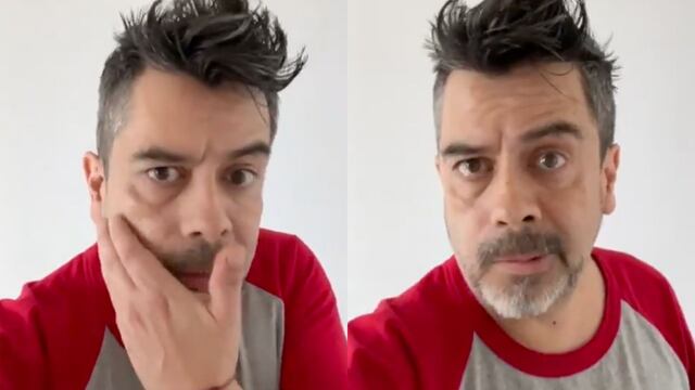 Carlos Espejel tiene parálisis facial