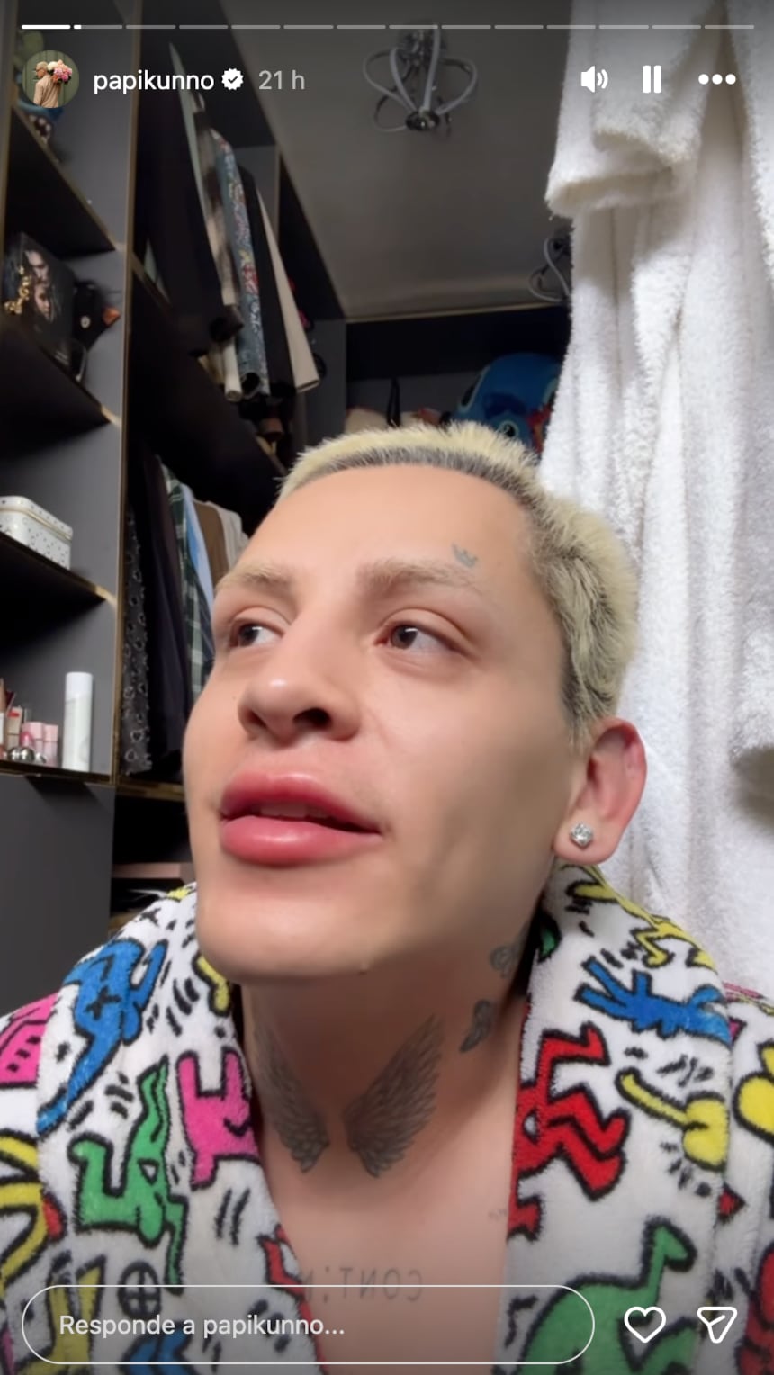 Kunno fue golpeado en ataque homofóbico en Monterrey