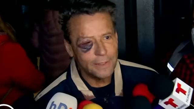 Alfredo Adame golpeado.