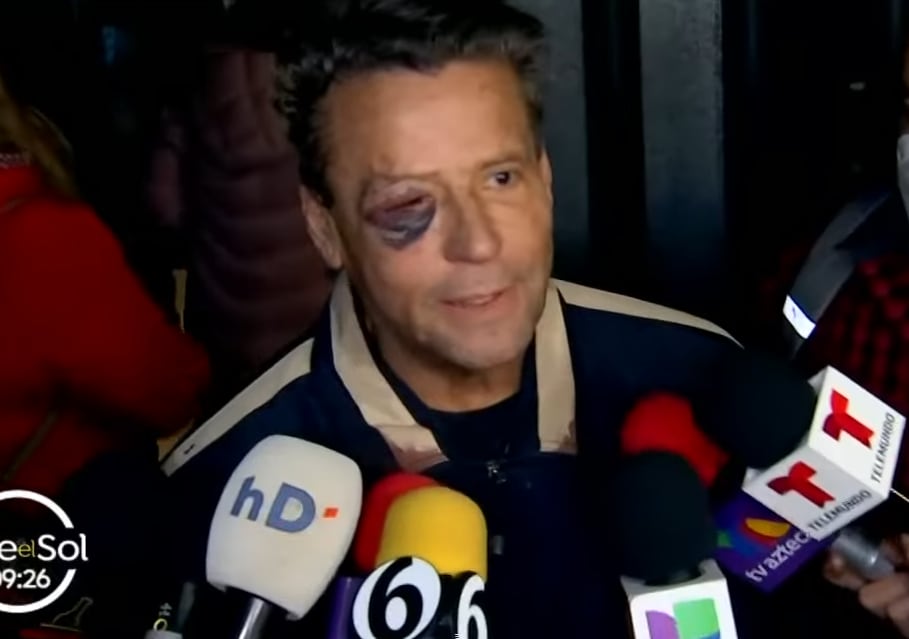 Alfredo Adame golpeado.