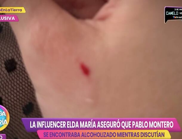 Pablo Montero le lastimó la mano a Elda María