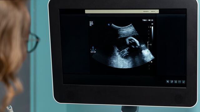 Una anciana murió tras intentar extirparle un feto calcificado