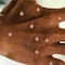 ¿Virus Mpox es la nueva emergencia sanitaria global? OMS tomará pronto una decisión