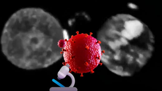 El video del avance que podría cambiar la lucha contra el VIH