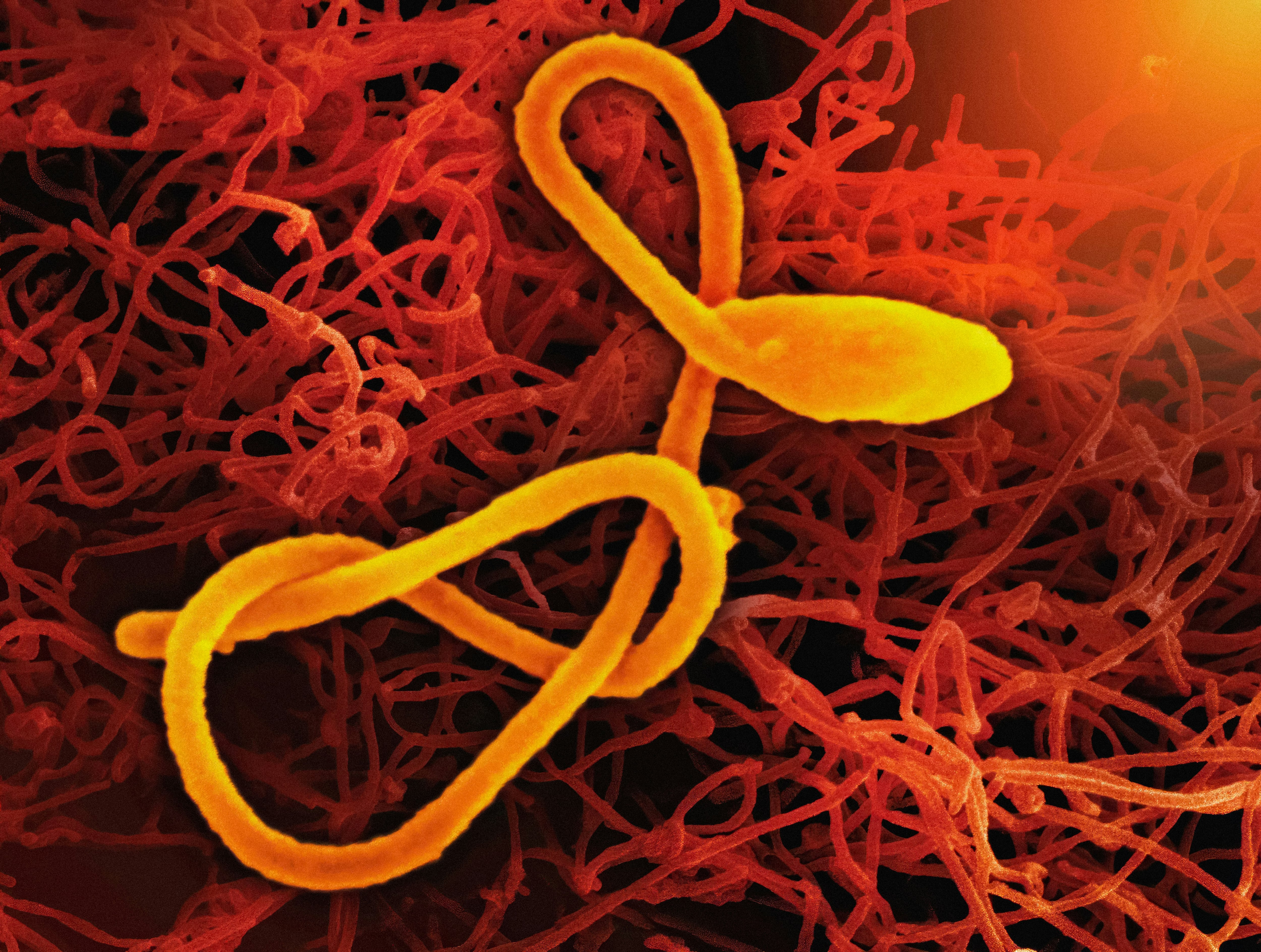 Tres vacunas contra el ébola están en desarrollo