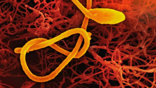 Tres vacunas contra el ébola están en desarrollo