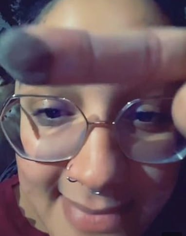 Vello púbico en dedo
