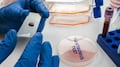 Hantavirus mantiene bajo riesgo de epidemia, según expertos