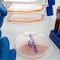 Hantavirus mantiene bajo riesgo de epidemia, según expertos
