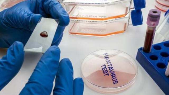 Hantavirus test