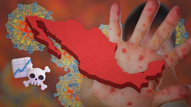 Reporte del brote de sarampión en México al 16 e febrero 2026