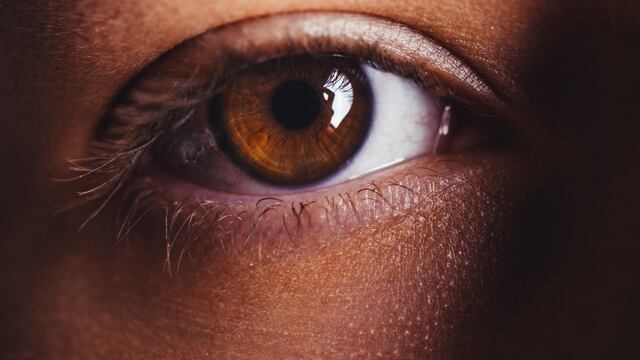 Ojo