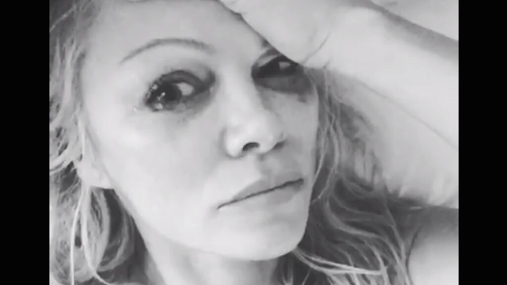 Pamela Anderson.
