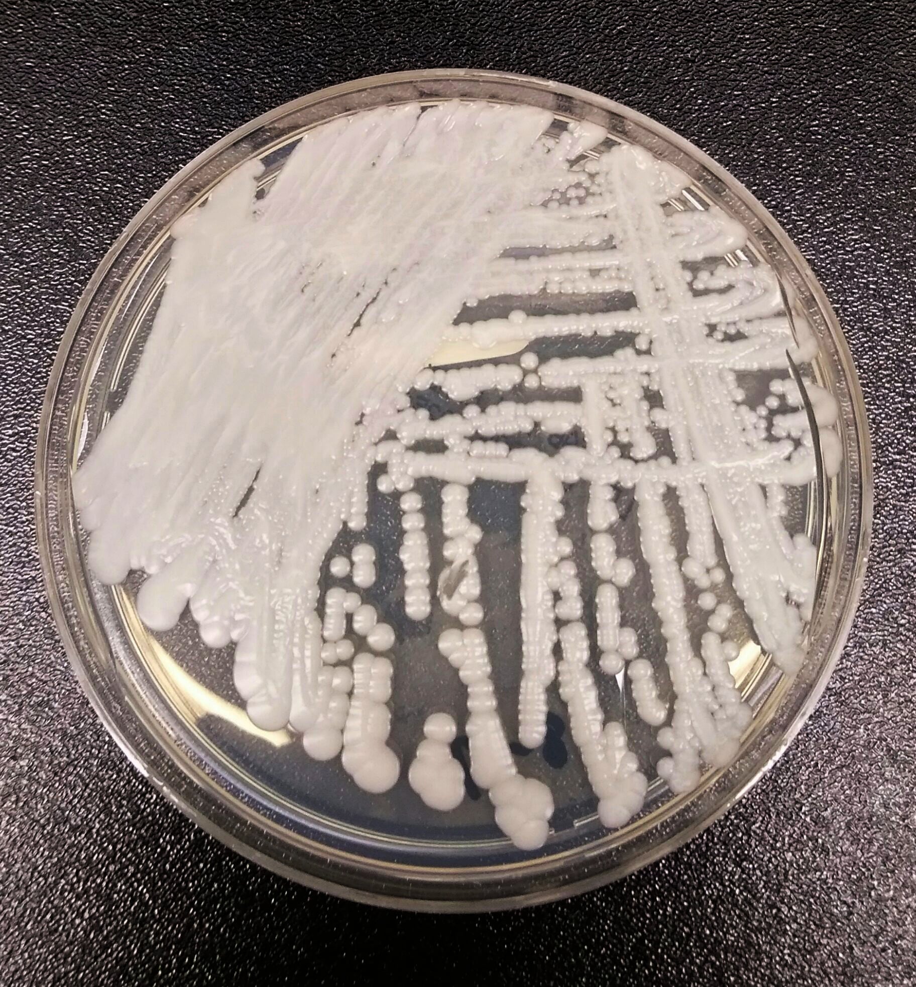 Hongo Candida auris