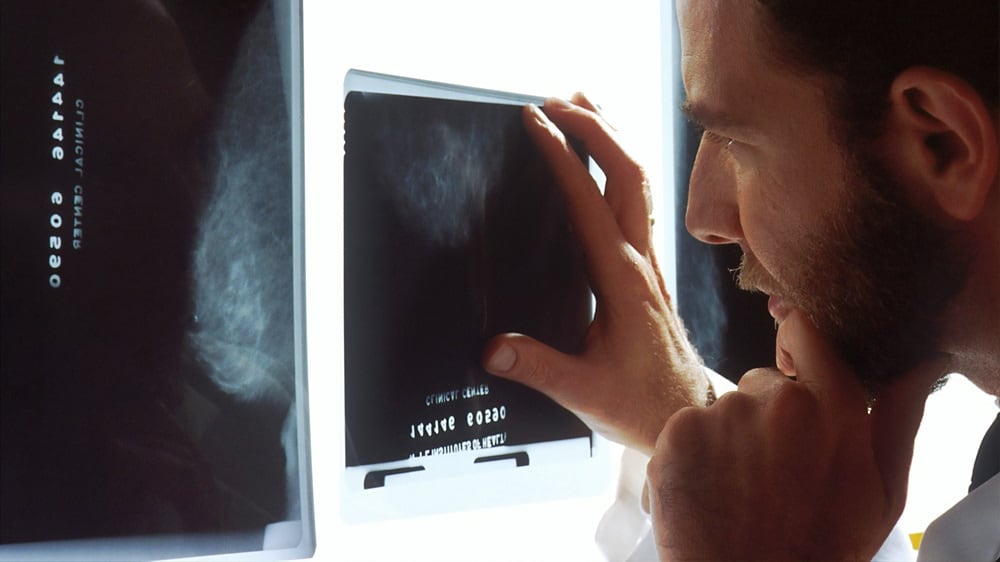 Medicamento contra el cáncer logra eliminar tumores agresivos: Esto se sabe