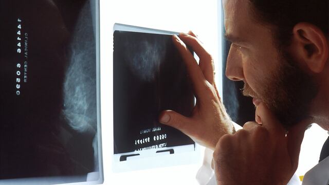 Cáncer de mama en hombres