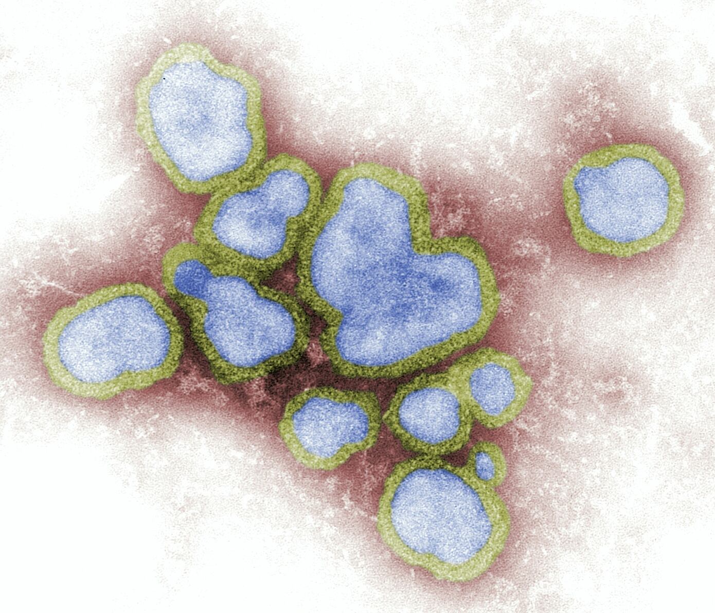 Virus B: síntomas y forma de contagio