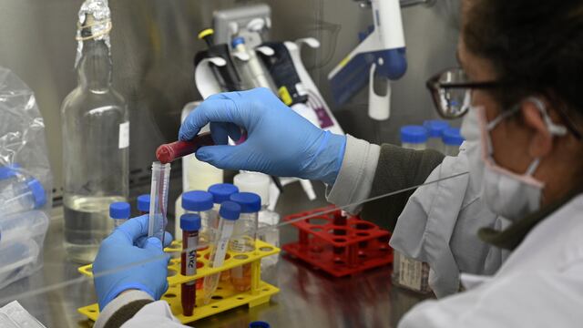 Estudio de la sangre