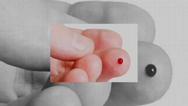 Desarrollada por investigadores de Amsterdam, esta prueba ha sido utilizada para analizar seis tipos de cáncer y ha permitido identificar la enfermedad en el 96 % de los casos.