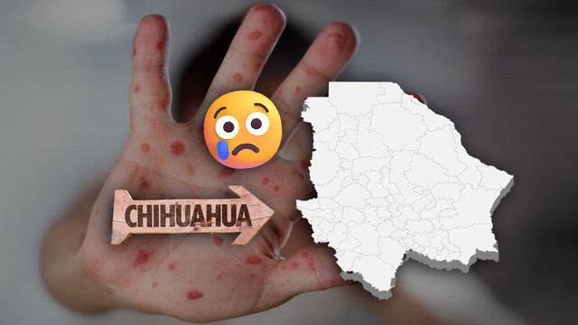 Reportan muerte de otra menor por sarampión en Chihuahua.