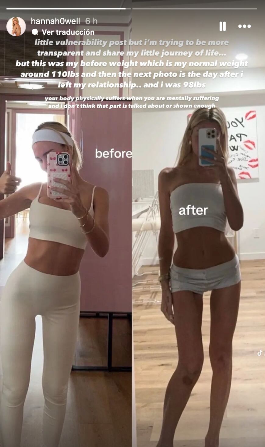 Hanna Howell sufrió daños físicos que le dejó su relación con Peso Pluma