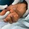 ¿Qué es el virus Mpox? La OMS se encuentra asustada por esta nueva cepa