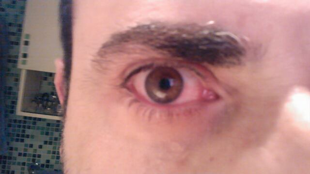 Se le había desprendido la retina