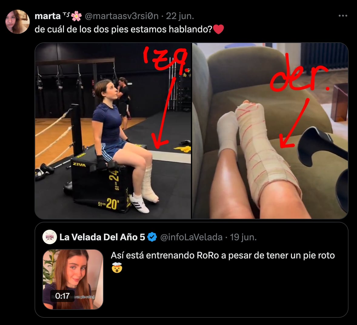 Usuarios cuestionan fractura de pie de Roro Bueno