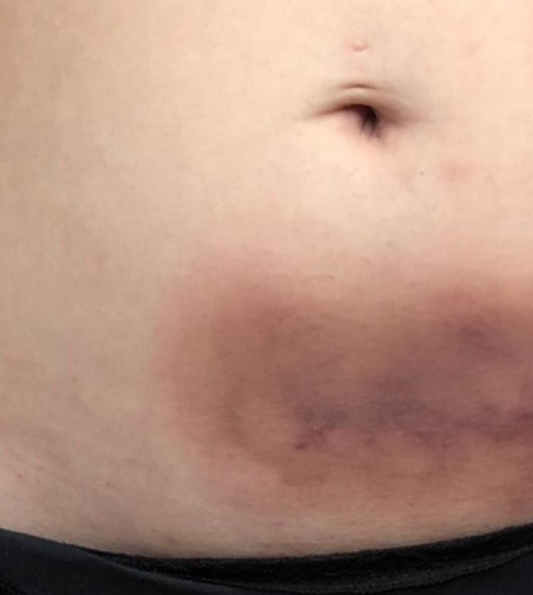 Golpes contra Kenya Mirelle