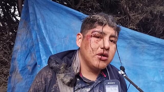 Víctor Hugo, quien despertó en el ataúd