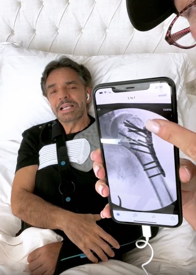 Radiografía de Eugenio Derbez