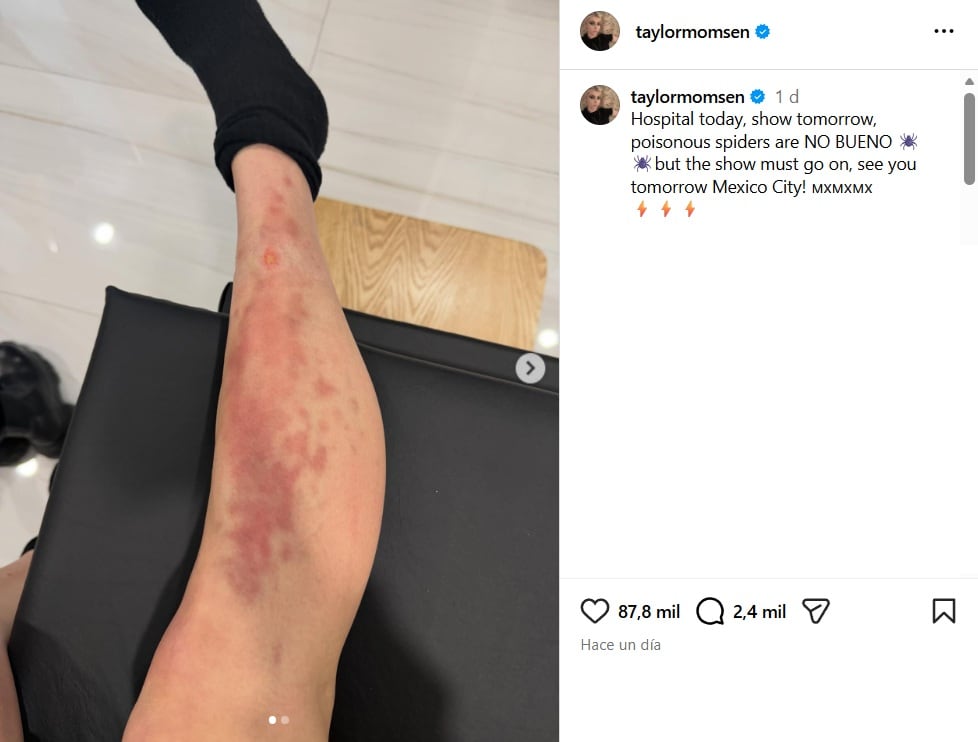 Taylor Momsen fue hospitalizada por picadura de araña en CDMX