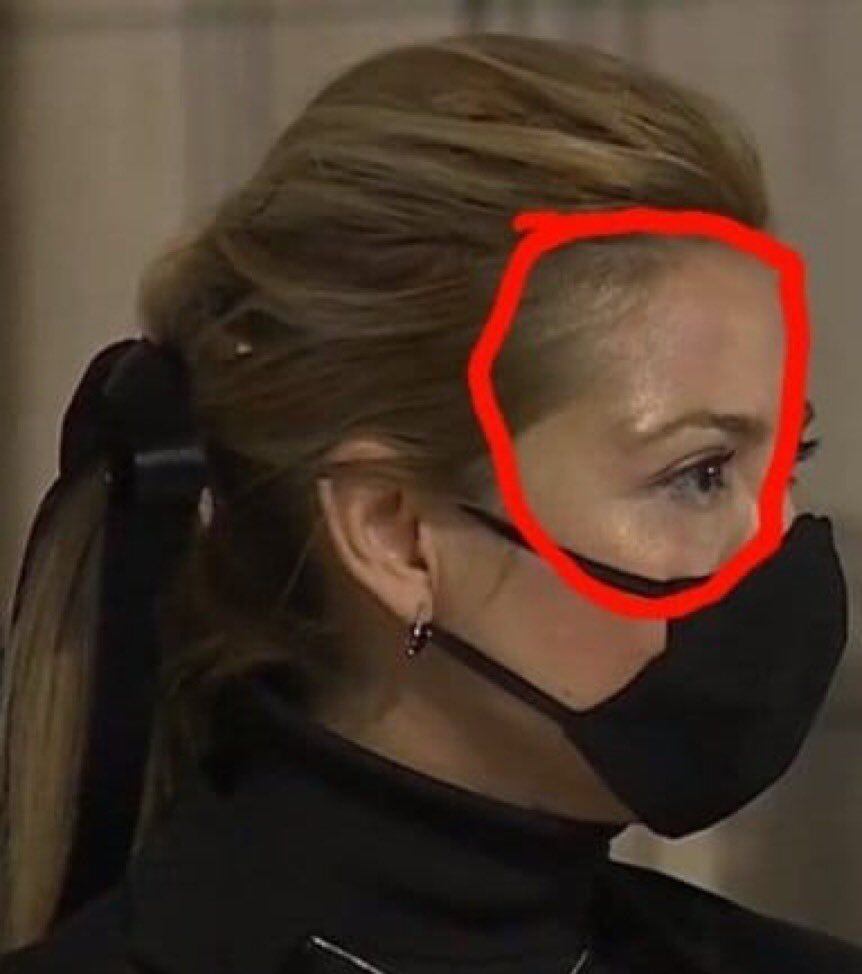 Fabiola Yañez con un presunto golpe