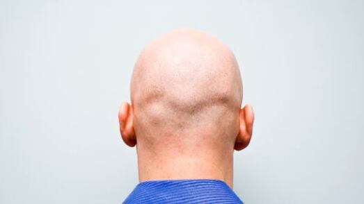 ¡Feliz Día de los Calvos! 15 frases de famosos para dedicar hoy 7 de octubre