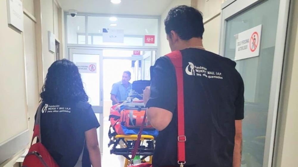 Reto viral con alcohol gel deja a niño de 7 años con quemaduras graves en Yucatán