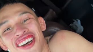 ¿Cómo está Lazy Boy? El peleador mexicano ya mandó mensaje desde el hospital