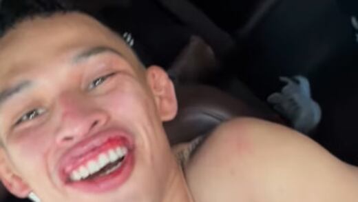 ¿Cómo está Lazy Boy? El peleador mexicano ya mandó mensaje desde el hospital