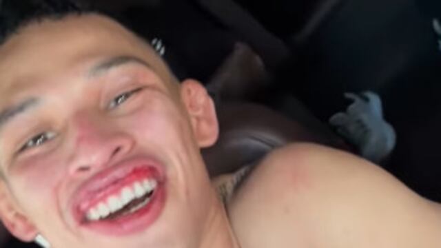 Lazy Boy mandó mensaje desde el hospital