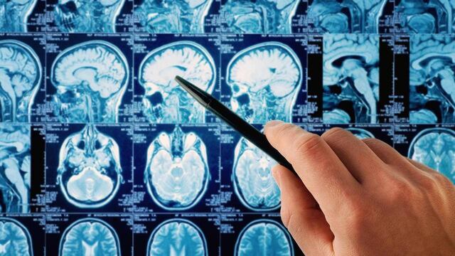 Radiografías de cerebro.