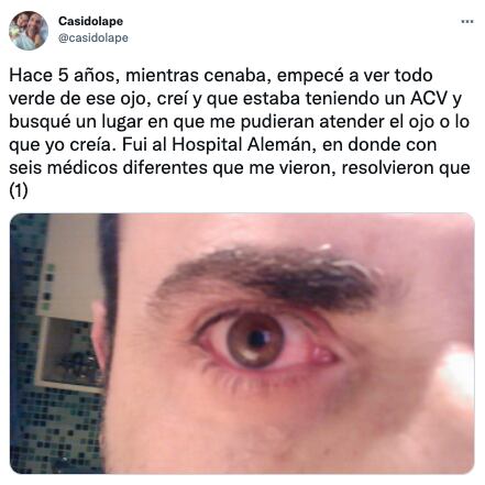 Se le había desprendido la retina