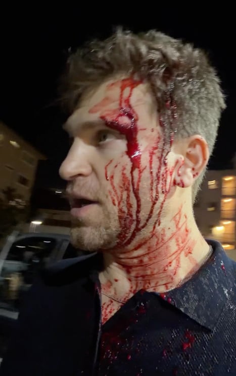 Keegan Allen sufre asalto