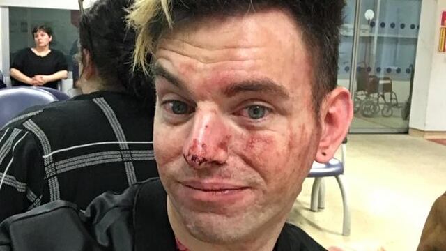 Lee Brobson fue golpeado tras defender a sus amigos