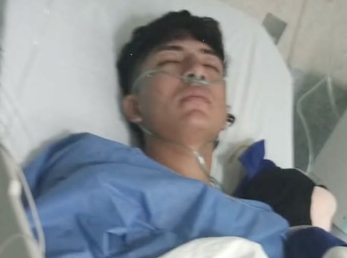 Cristian Carranza sufrió agresiones con fuego en CEDVA de Texcoco