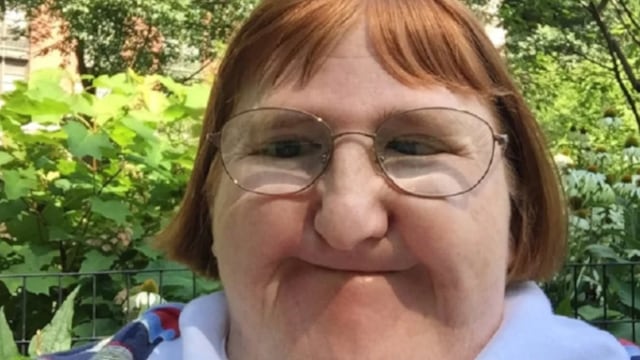 A Melissa Blake le dijeron que era demasiado fea para tomarse selfies, pero ella no lo creyó.