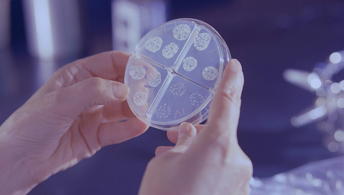 Bacteria