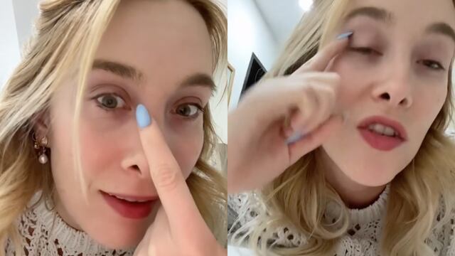 VIDEO: Sentía dolor en el ojo y cuenta en TikTok cómo le encontraron un “cabello gigante” adentro