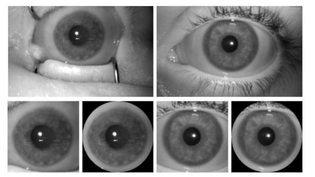 Las imágenes de ojos analizadas por un algoritmo de Inteligencia Artificial.