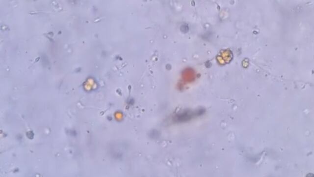 El video demuestra que la salsa mata espermatozoides